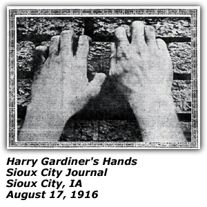 Harry Gardiner's Hands - Sioux City Journal - Sioux City, IA - August 17, 1916